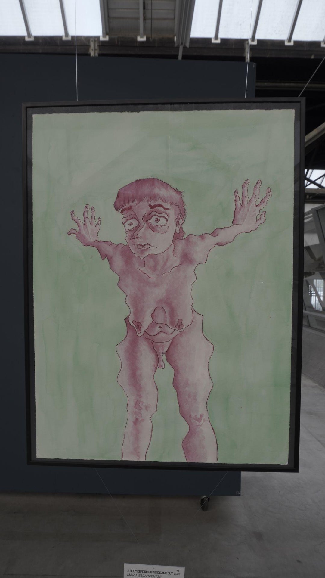 A body deformed inside and out